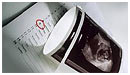 Nye retningslinier for fosterdiagnostik
