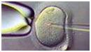 Mand fyret efter fertilitetsbehandling